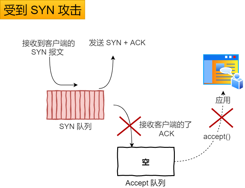 受到 SYN 攻击时的队列示意图